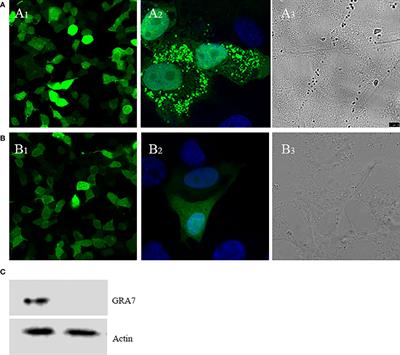 Enhancing Immune Responses to a DNA Vaccine Encoding Toxoplasma gondii GRA7 Using Calcium Phosphate Nanoparticles as an Adjuvant